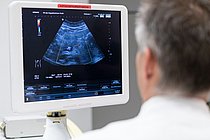 Wenn die Speiseröhre brennt: Reflux